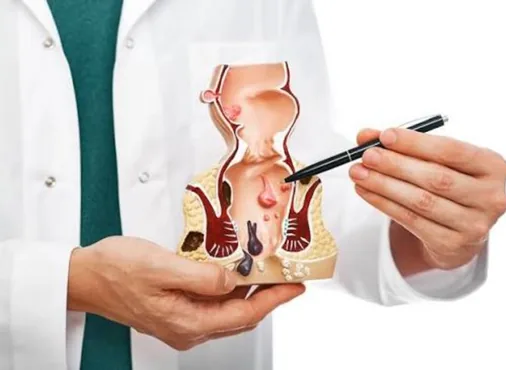 Anal Disorders